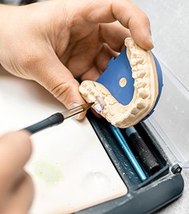 Endodontics — root canal treatment